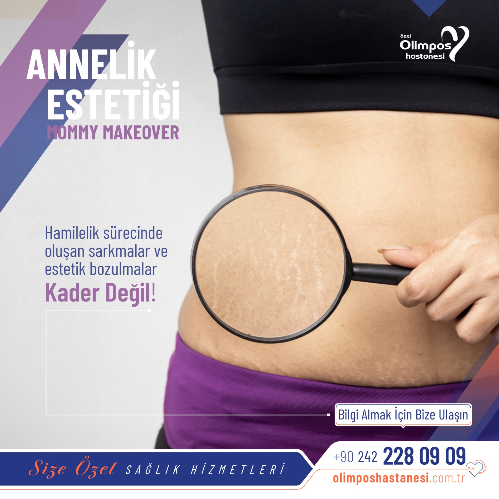 MOMMY MAKEOVER - ANNELİK ESTETİĞİ -en
