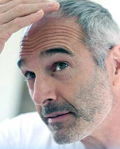 Things to Watch Before Hair Transplantation